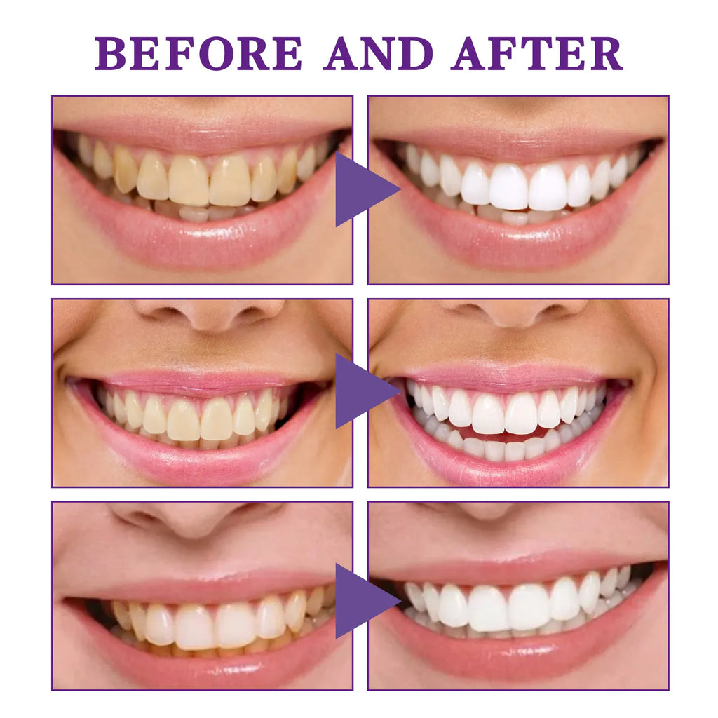 Tooth Cleaning Mousse